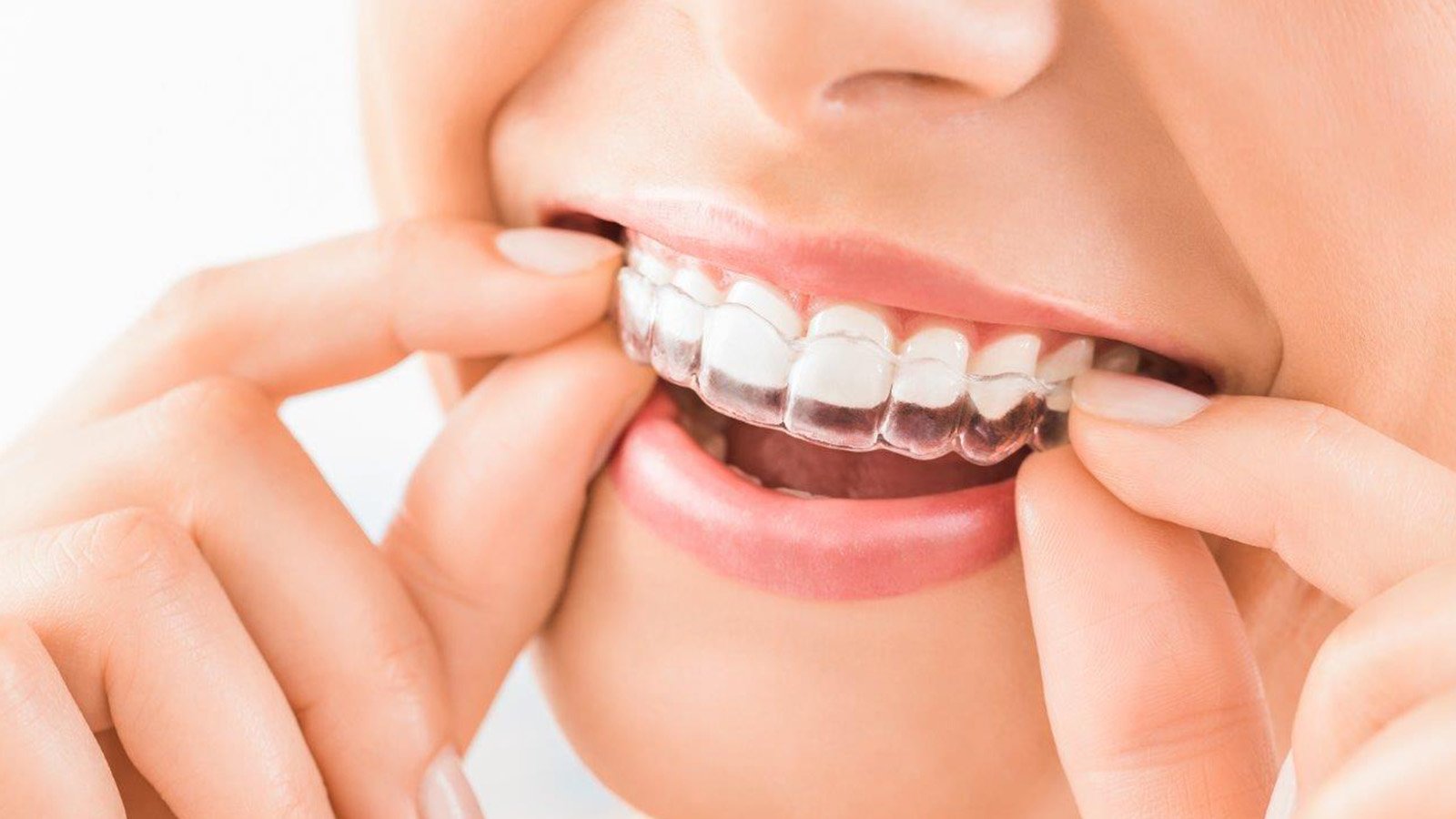 Orthodontics