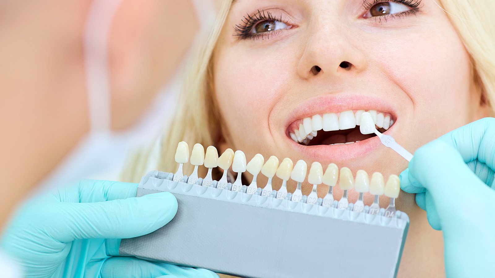 Teeth Whitening